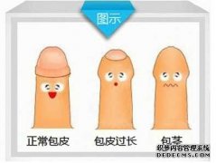 内蒙古包皮过长不做手术行吗?哪些人必须做包皮手术?