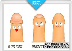 内蒙古做包皮手术应该注意什么